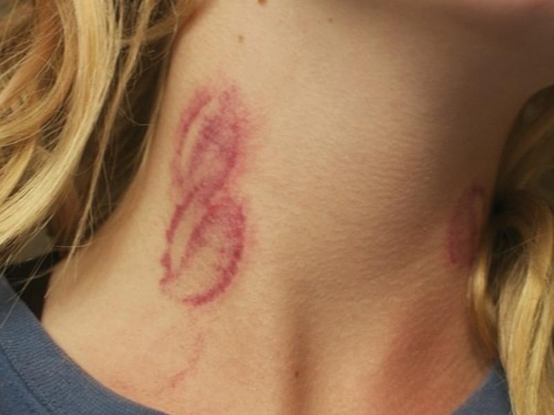 Hickey là một từ tiếng Anh có nghĩa là “nụ hôn trên cổ”